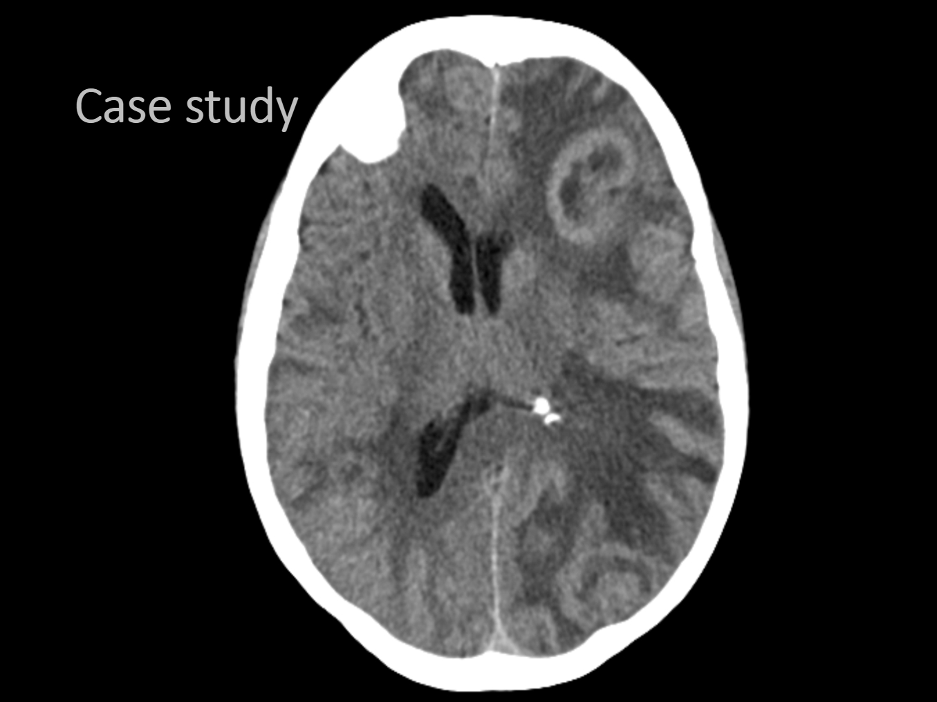 CEU Header Slides3 Ceu Header Slides3